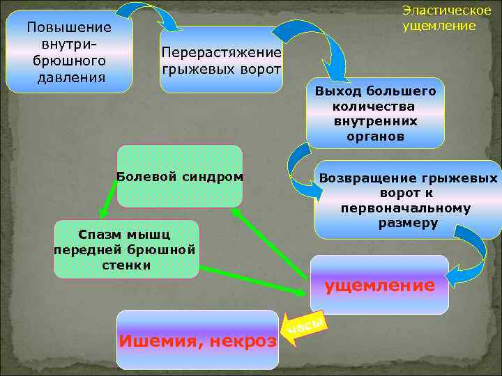 Повышение внутрибрюшного давления Эластическое ущемление Перерастяжение грыжевых ворот Выход большего количества внутренних органов Болевой