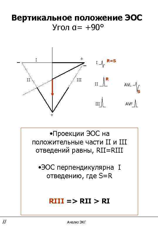 Вертикальное положение ЭОС Угол α= +90° _ + _ I II I R=S R
