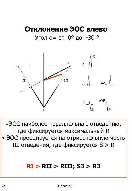 Отклонение ЭОС влево Угол α= от 0° до -30 ° R _ + _