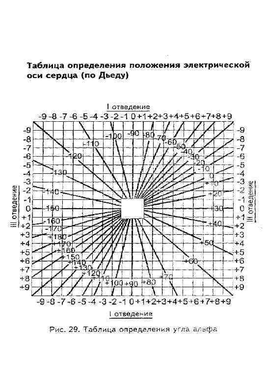 Оси сердца рисунок