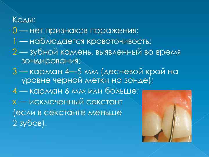 Коды: 0 — нет признаков поражения; 1 — наблюдается кровоточивость; 2 — зубной камень,