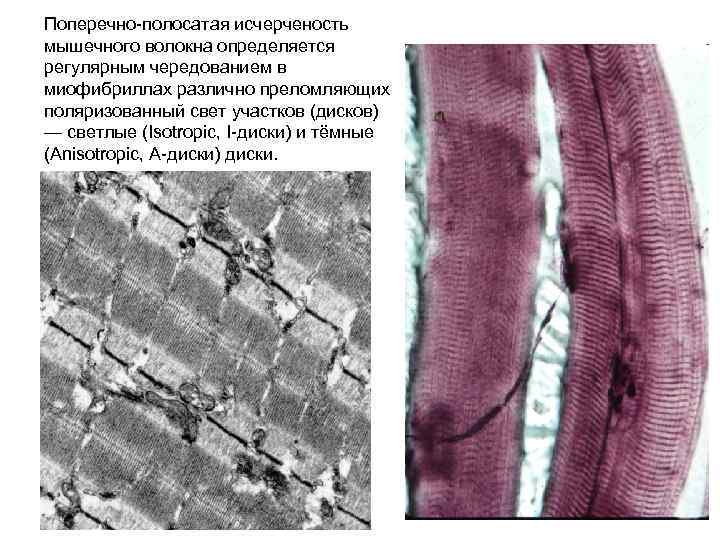 Поперечно-полосатая исчерченость мышечного волокна определяется регулярным чередованием в миофибриллах различно преломляющих поляризованный свет участков