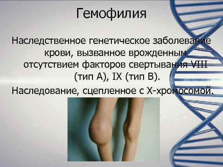   Гемофилия Наследственное генетическое заболевание  крови, вызванное врожденным  отсутствием факторов свертывания