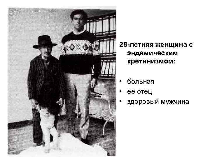 28 -летняя женщина с  эндемическим  кретинизмом:  •  больная • 