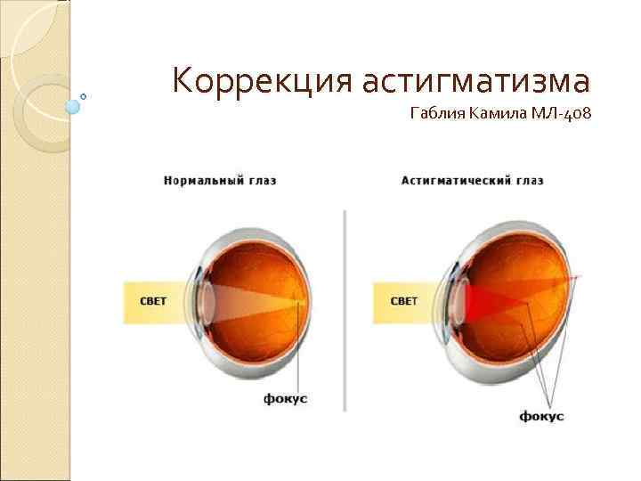 Транспозиция астигматических линз калькулятор