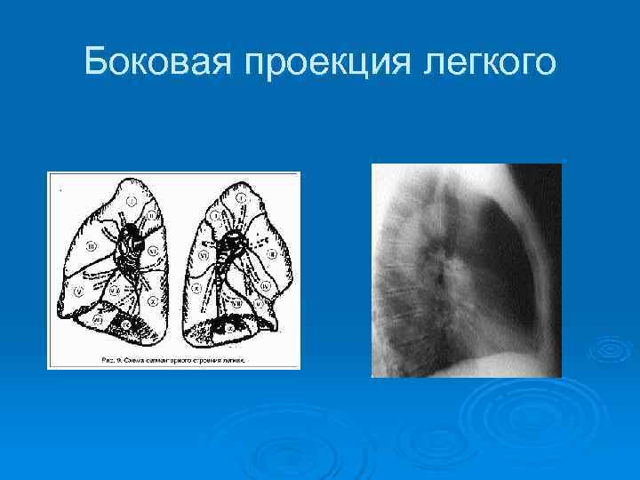 Проекция легких. Боковая проекция лёгких. Легкие в боковой проекции. Боковая проекция легких схема. Правая боковая проекция легких.