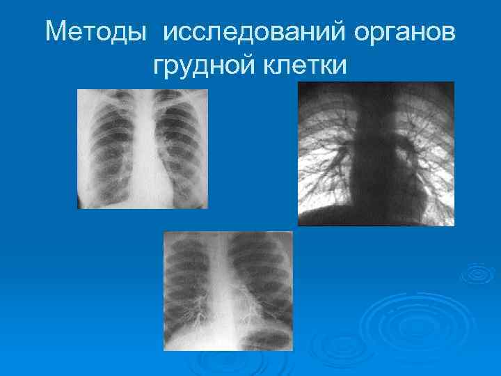 Методы исследований органов  грудной клетки 