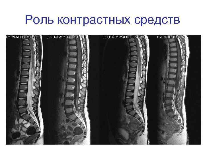 Роль контрастных средств 