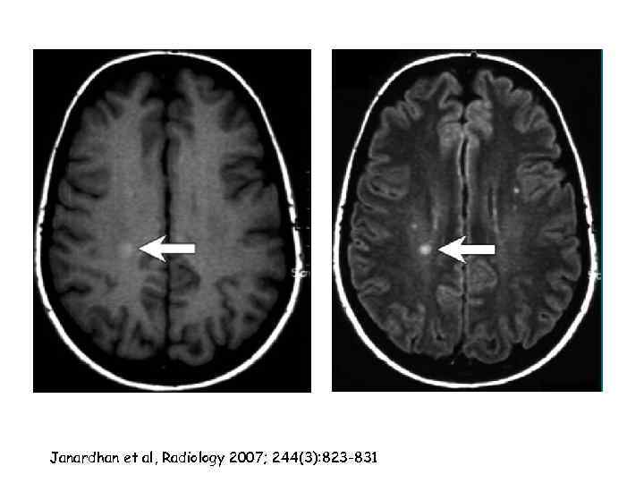 Janardhan et al, Radiology 2007; 244(3): 823 -831 