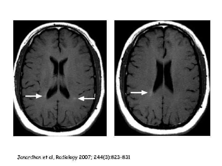 Janardhan et al, Radiology 2007; 244(3): 823 -831 