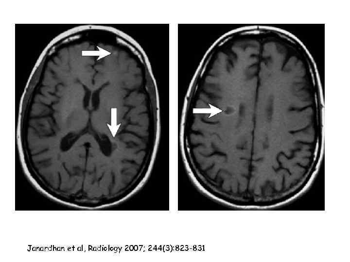 Janardhan et al, Radiology 2007; 244(3): 823 -831 