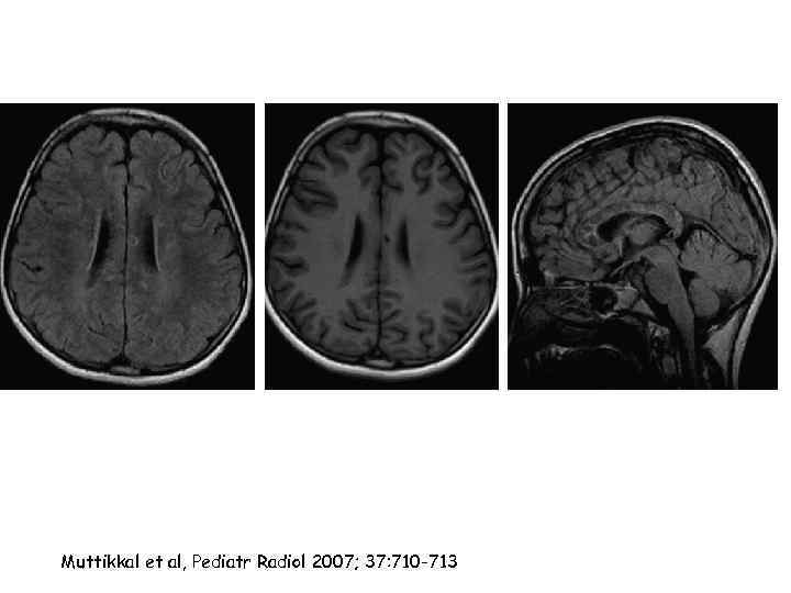 Muttikkal et al, Pediatr Radiol 2007; 37: 710 -713 