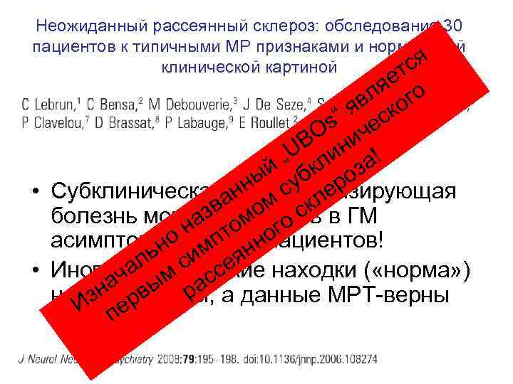 Неожиданный рассеянный склероз: обследование 30 пациентов к типичными МР признаками и нормальной ся клинической
