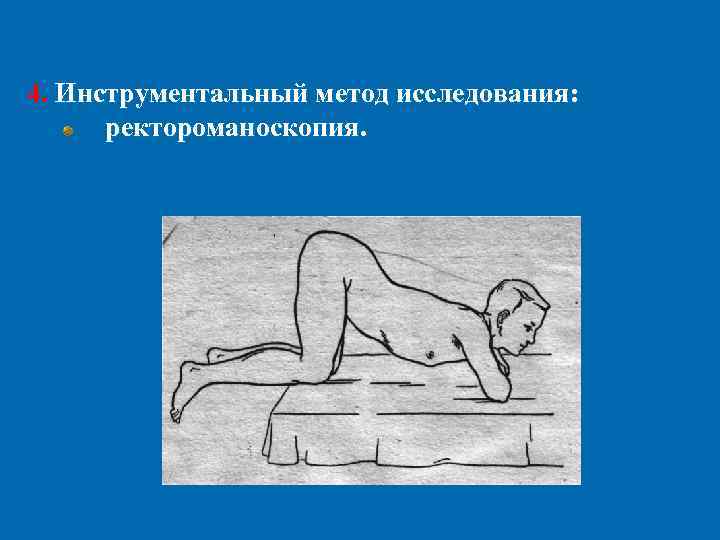 4. Инструментальный метод исследования:  ректороманоскопия. 