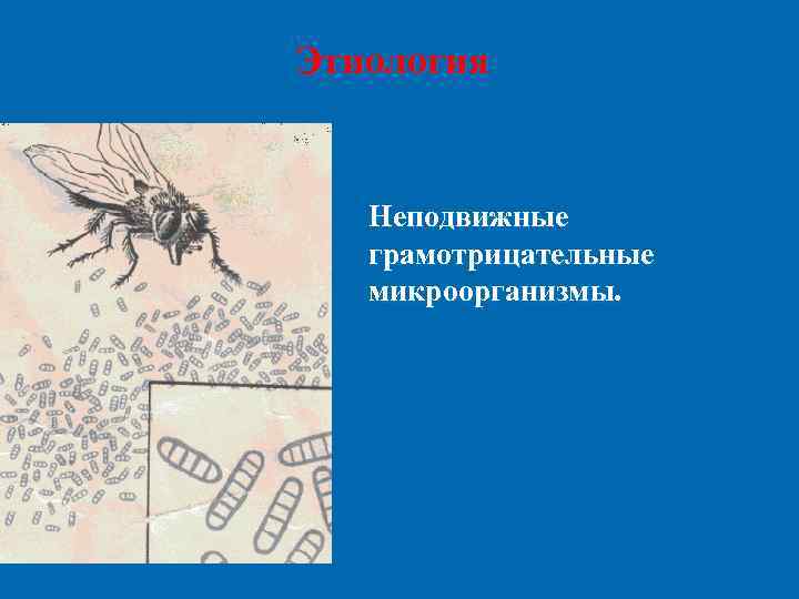 Этиология Неподвижные  грамотрицательные  микроорганизмы. 