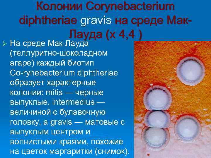    Колонии Corynebacterium  diphtheriae gravis на среде Мак   Лауда