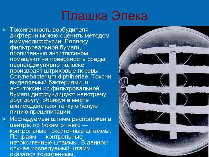     Плашка Элека Ø Токсигенность возбудителя  дифтерии можно оценить методом