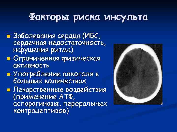   Факторы риска инсульта n  Заболевания сердца (ИБС, сердечная недостаточность, нарушения ритма)