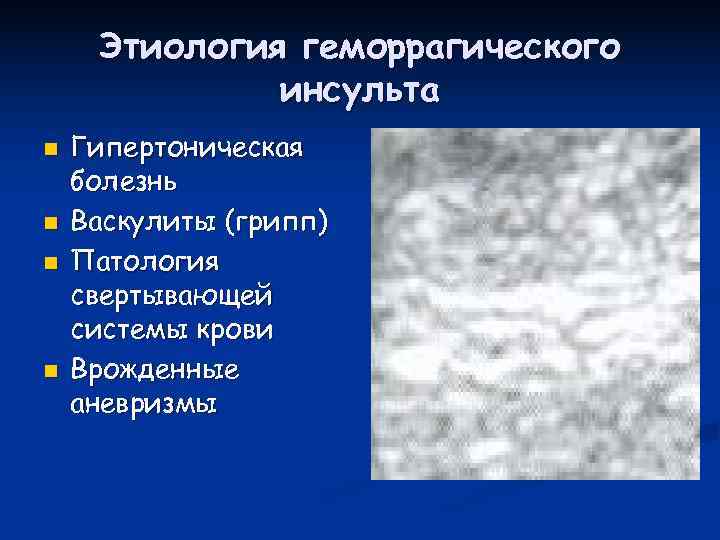  Этиология геморрагического    инсульта n  Гипертоническая болезнь n  Васкулиты
