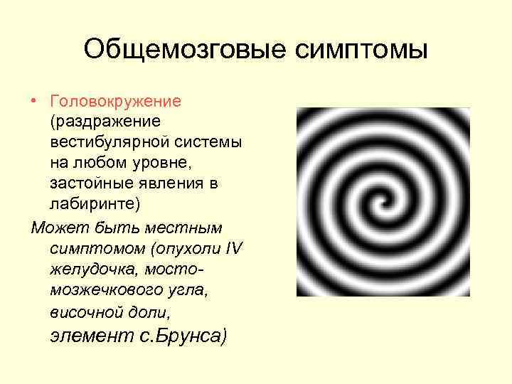  Общемозговые симптомы • Головокружение  (раздражение  вестибулярной системы  на любом уровне,