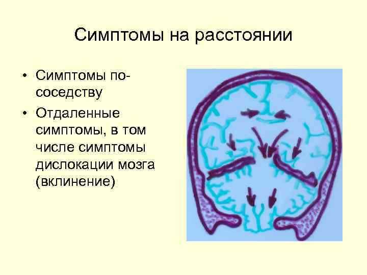   Симптомы на расстоянии  • Симптомы по-  соседству • Отдаленные 