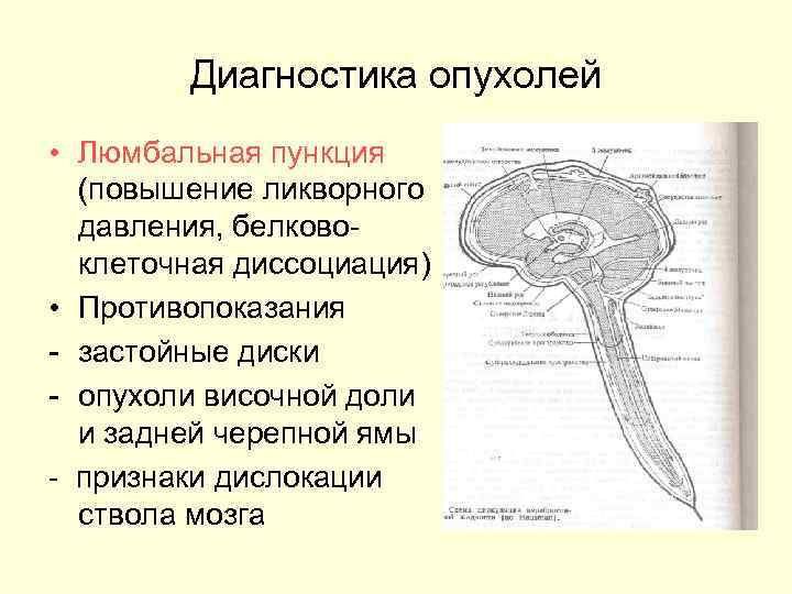   Диагностика опухолей • Люмбальная пункция  (повышение ликворного  давления, белково- 