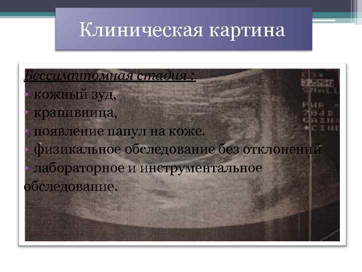  Клиническая картина Бессимптомная стадия : • кожный зуд, • крапивница, • появление папул