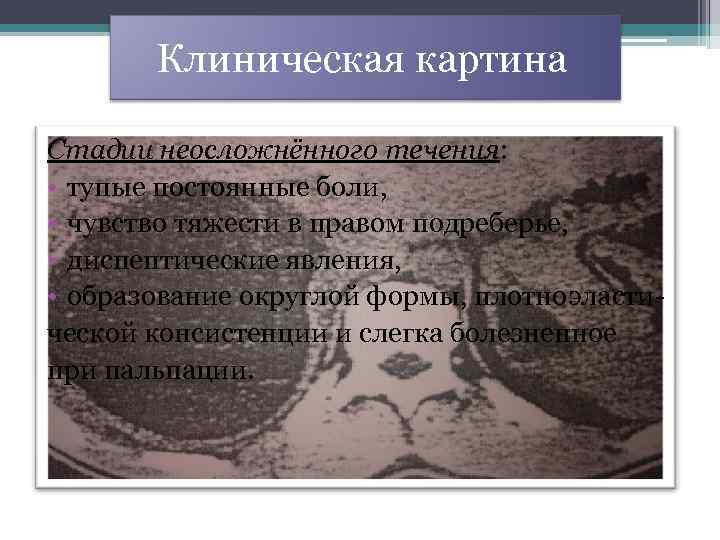  Клиническая картина Стадии неосложнённого течения: • тупые постоянные боли, • чувство тяжести в