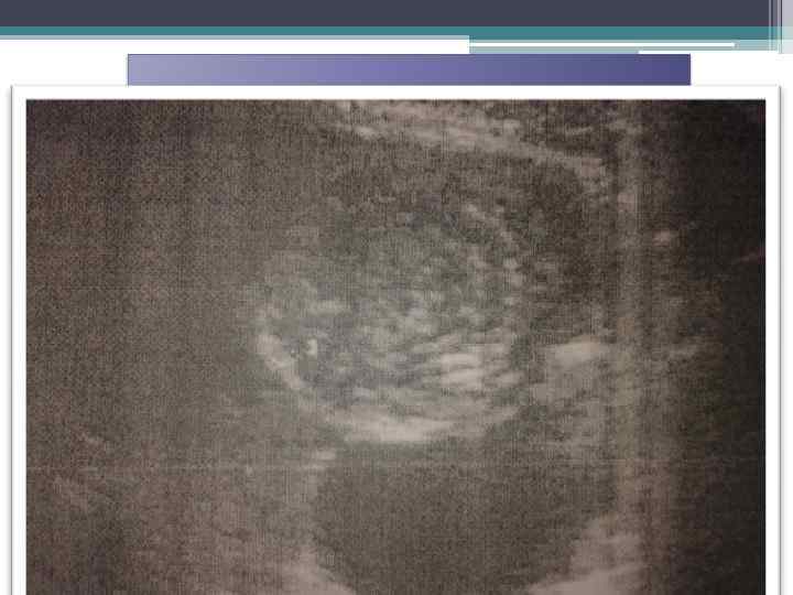  Осложнения 