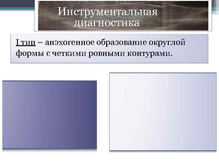  Инструментальная диагностика I тип – анэхогенное образование округлой формы с четкими ровными контурами.
