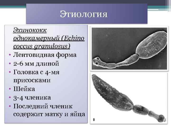 Презентация на тему эхинококкоз