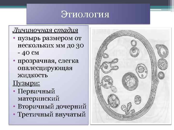  Этиология Личиночная стадия • пузырь размером от нескольких мм до 30 - 40