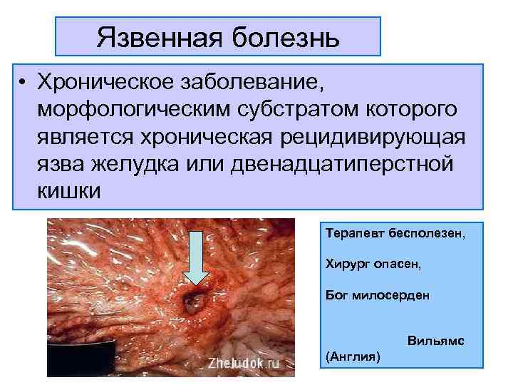 Анатомия жкт фото