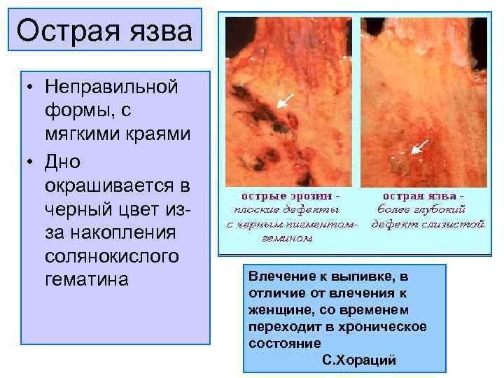 Презентация патологическая анатомия