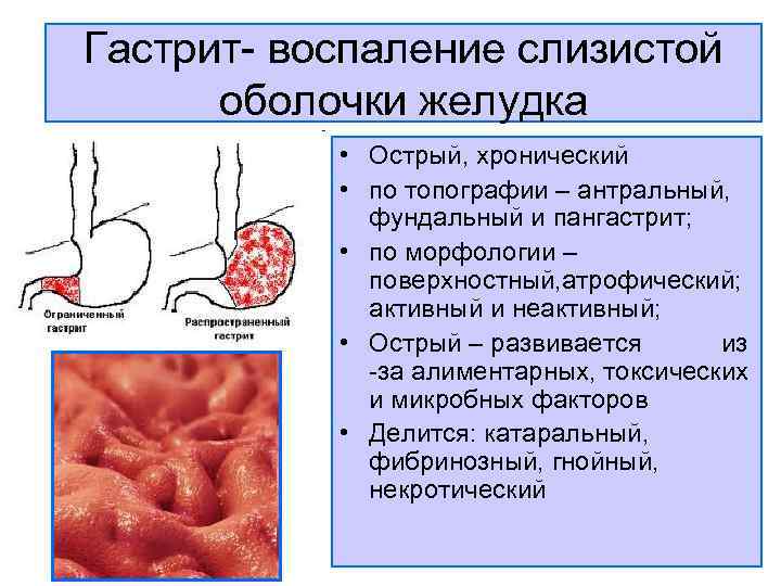 Анатомия жкт фото