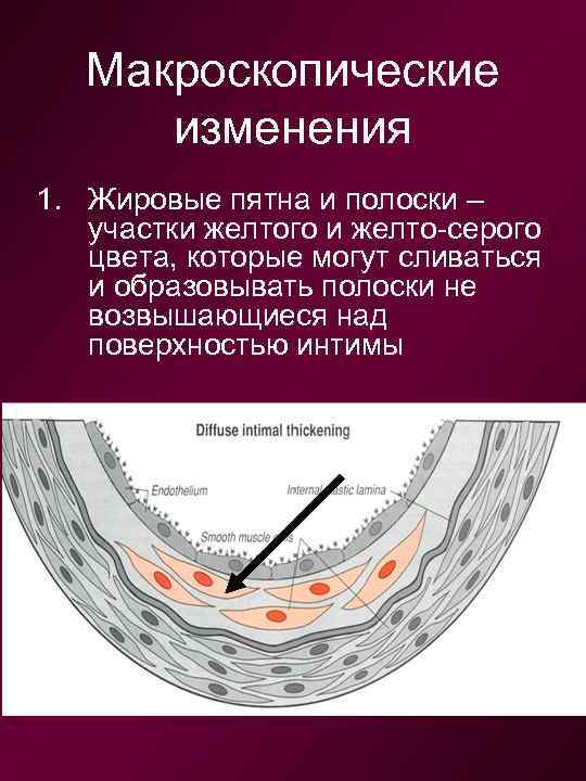 Изменение анатомии водительского кресла