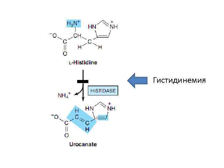 Гистидинемия 