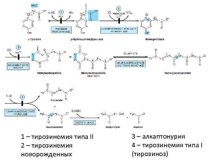 1 – тирозинемия типа II  3 – алкаптонурия 2 – тирозинемия  4