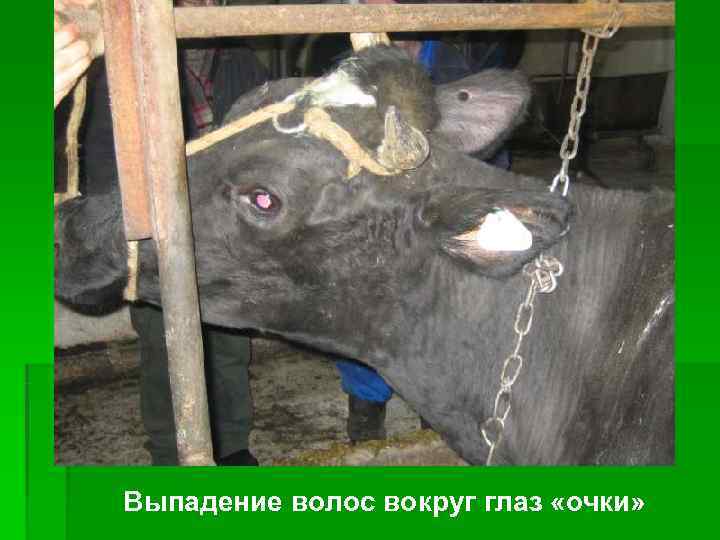 Выпадение волос вокруг глаз «очки» 