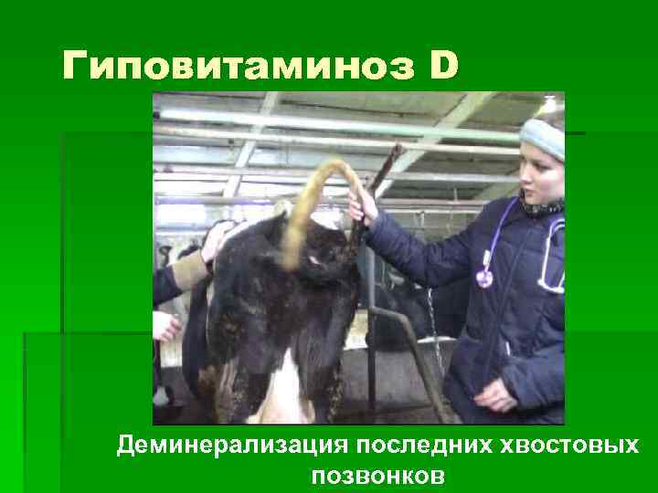 Гиповитаминоз D  Деминерализация последних хвостовых    позвонков 