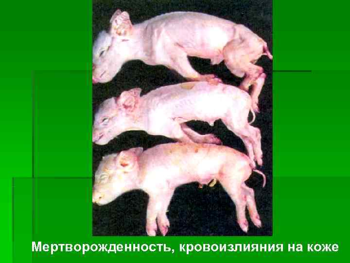 Мертворожденность, кровоизлияния на коже 