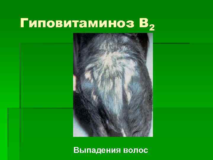 Гиповитаминоз В 2  Выпадения волос 
