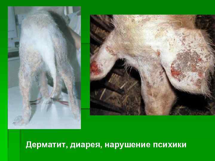 Дерматит, диарея, нарушение психики 