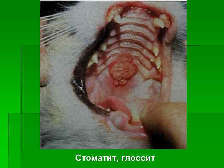 Стоматит, глоссит 