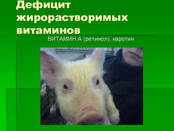 Дефицит жирорастворимых витаминов ВИТАМИН А (ретинол), каротин 