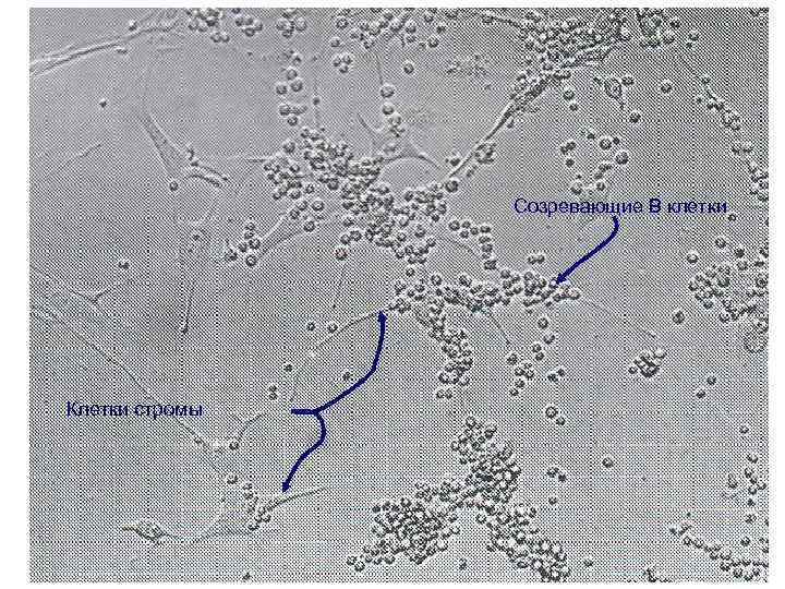 Созревающие В клетки Клетки стромы 