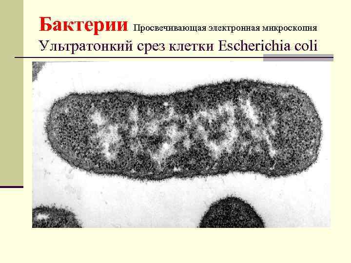 Бактерии Просвечивающая электронная микроскопия Ультратонкий срез клетки Escherichia coli 