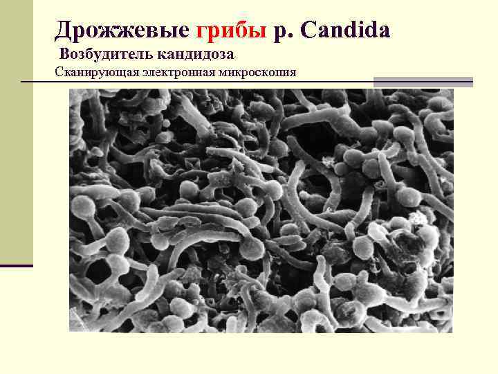 Дрожжевые грибы р. Candida Возбудитель кандидоза Сканирующая электронная микроскопия 
