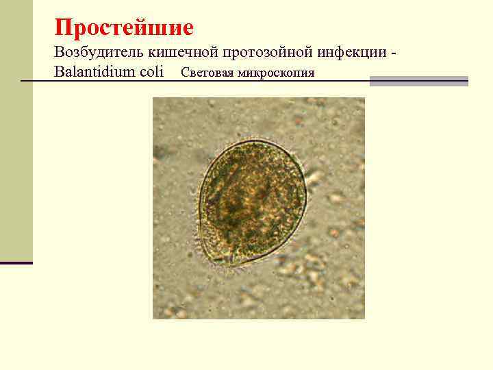 Простейшие Возбудитель кишечной протозойной инфекции - Balantidium coli Световая микроскопия 