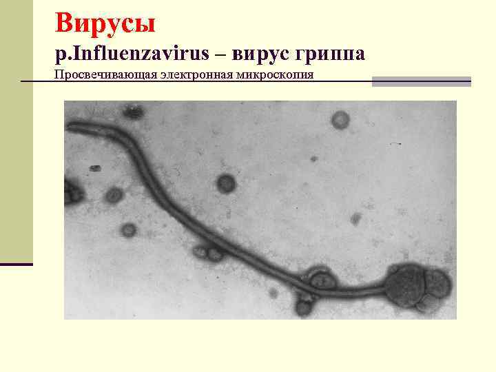 Вирусы р. Influenzavirus – вирус гриппа Просвечивающая электронная микроскопия 